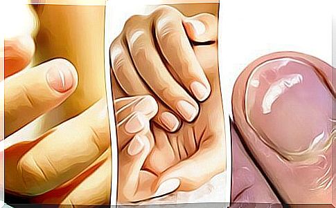 5 signs that the nails indicate a health problem