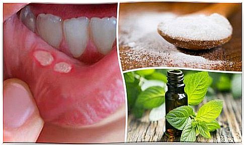 7 natural treatments for canker sores