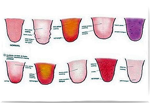 9 clues provided by the appearance of the tongue regarding your health