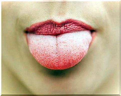 Which indicates the appearance of the tongue of a whitish hue