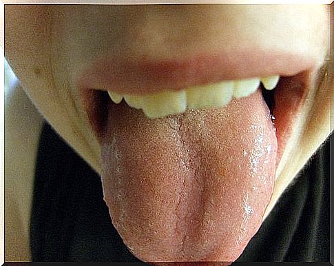 The tongue may have lesions that indicate a serious health problem