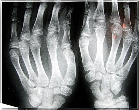 Radiography after snapping fingers