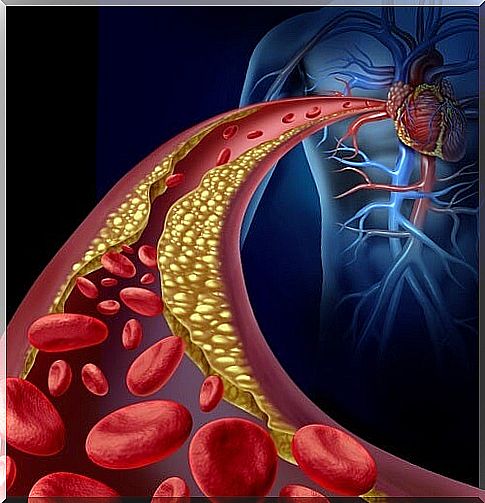 How to lower your triglyceride levels