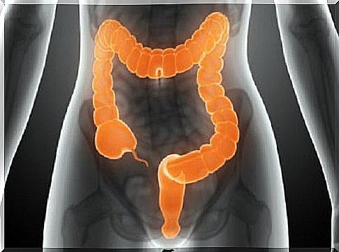 Intestinal gas can be a symptom of irritable bowel syndrome