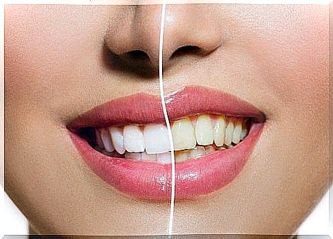 Natural products for teeth whitening at home