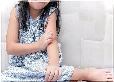 Psoriasis in children: how to deal with it