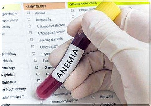 Tests that show anemia