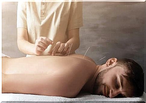 Treatment of joint pain with acupuncture