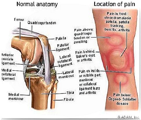 Patellar chondromalacia