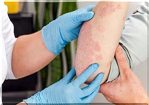 Types of skin rashes and their causes