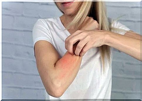 Girl with rashes on the skin