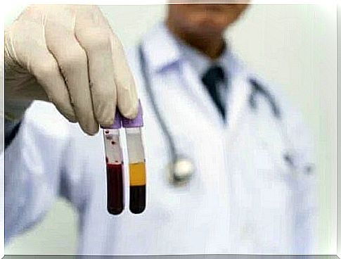 Doctor holding blood tubes in his hand