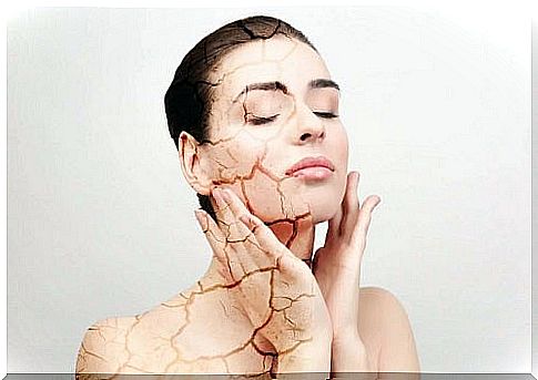 Causes of dry skin in women